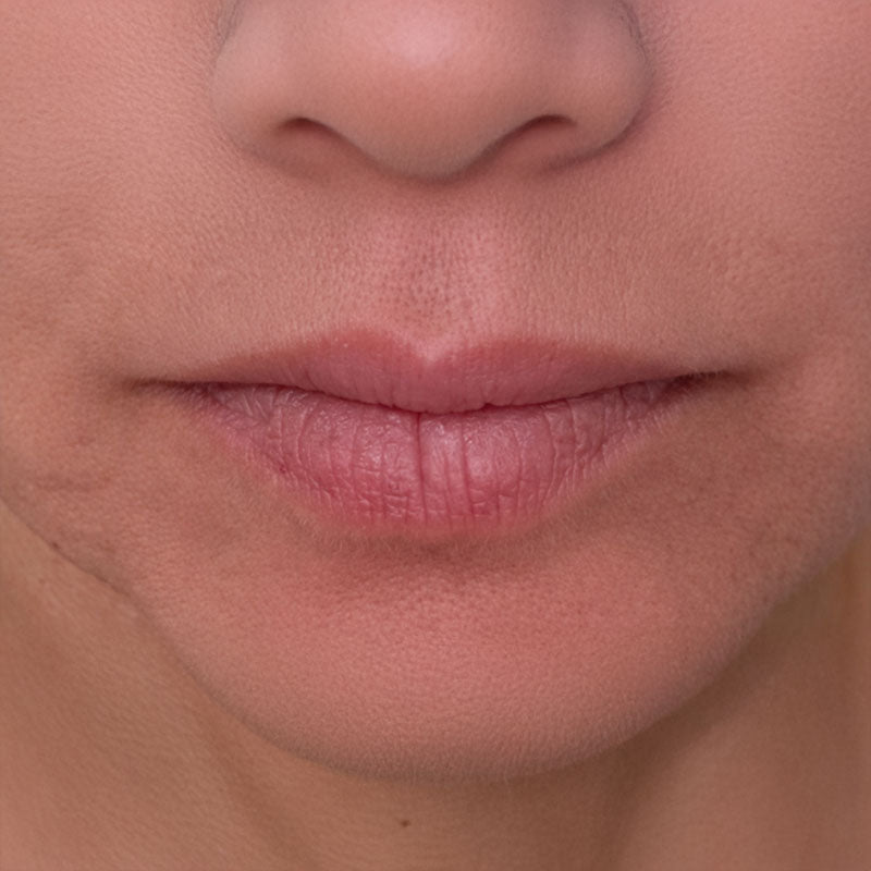Before — Jolaine, Verified Reviewer