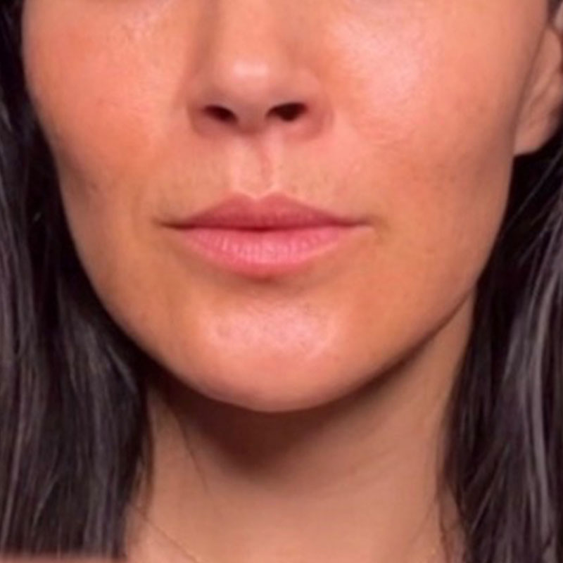 Before — Shelly, Verified Reviewer