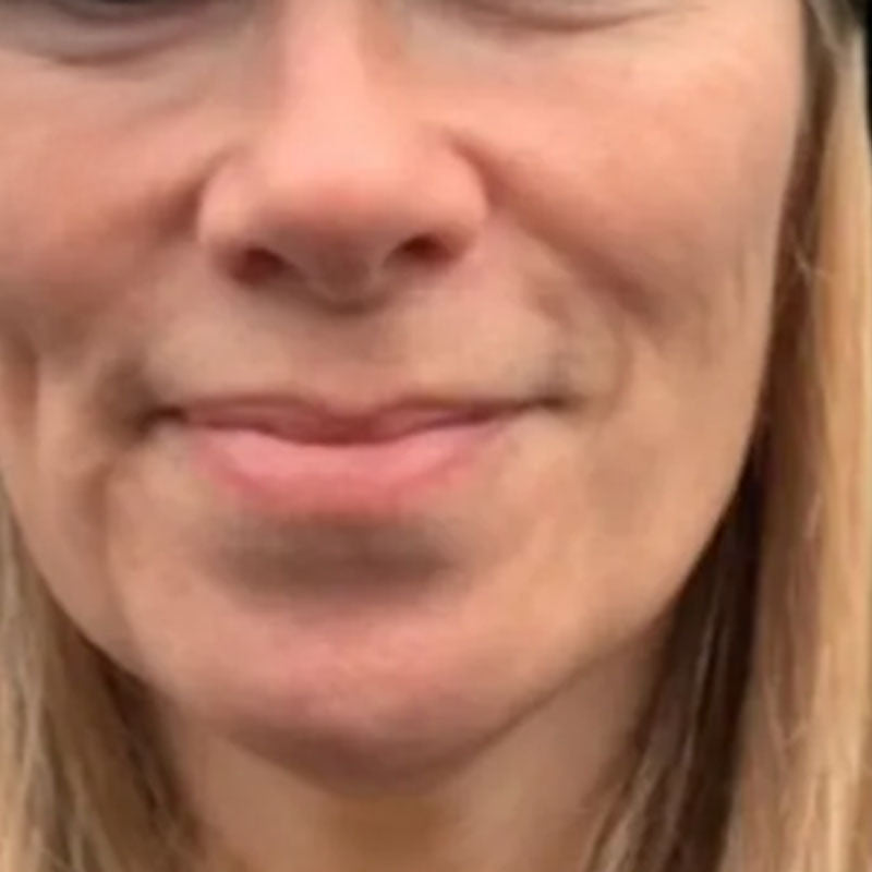 Before — Vanessa, Verified Reviewer